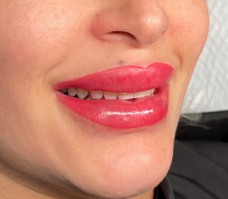Después: MICROPIGMENTACIÓN DE LABIOS | ANTES Y DESPUÉS